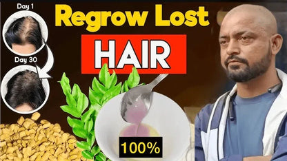 🔥Advance Jamalgata Aryurvedic Hair Growth Tonic Buy 1 Get 1 Free 🔥